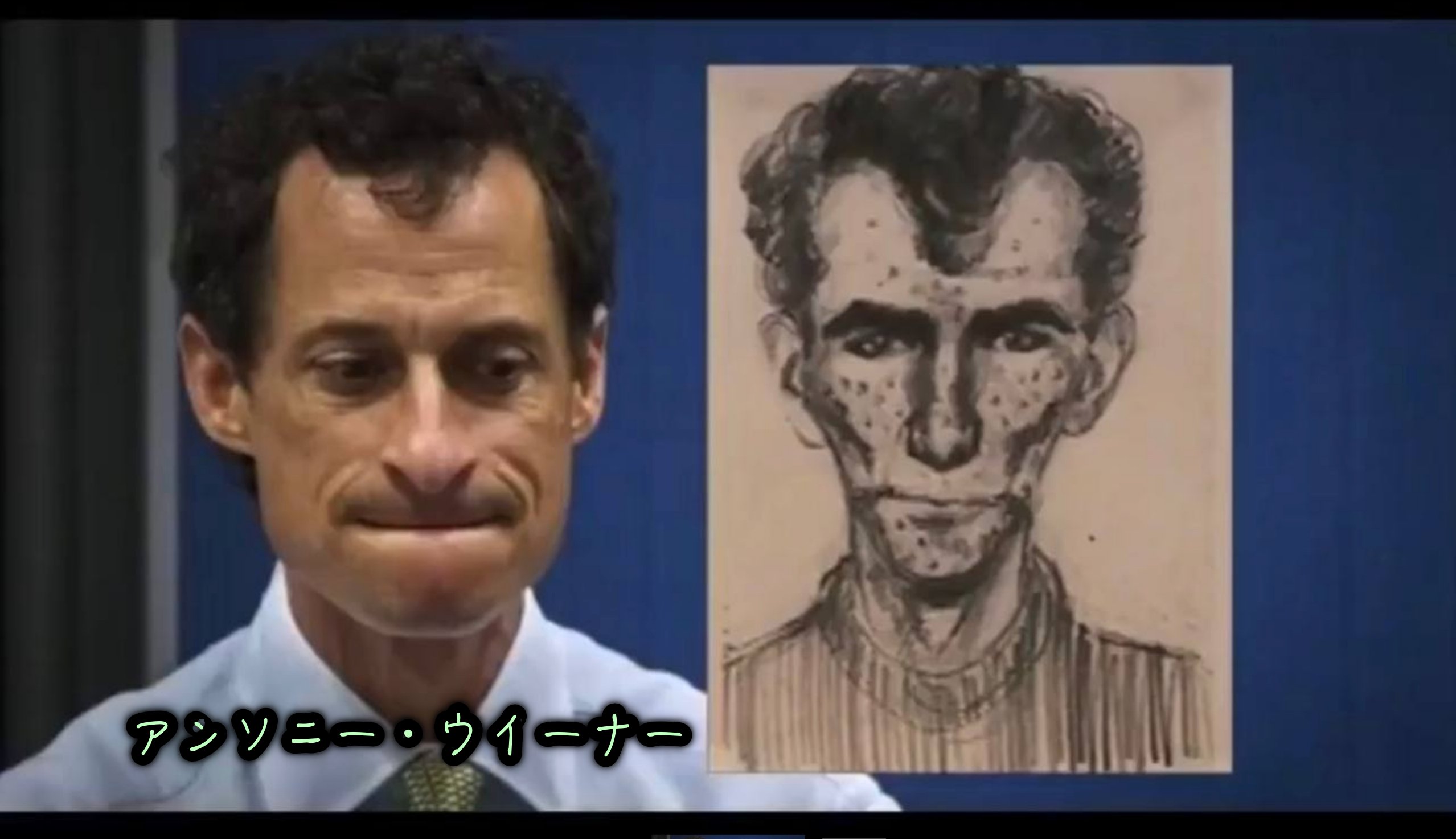 アンソニー・ウイーナー
